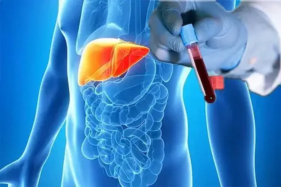Liver Profile